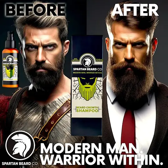 𝗦𝗣𝗔𝗥𝗧𝗔𝗡 𝗕𝗘𝗔𝗥𝗗™ Shampoo (80% DISKWENTO - Unang Order)